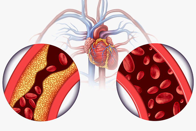 Inhibidores de ECA para la tensión arterial