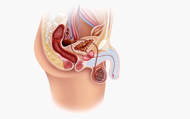 La balanitis causa dolor en el pene, inflamación y comezón