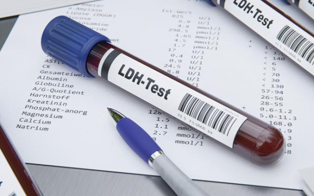 LDH en un análisis de sangre.