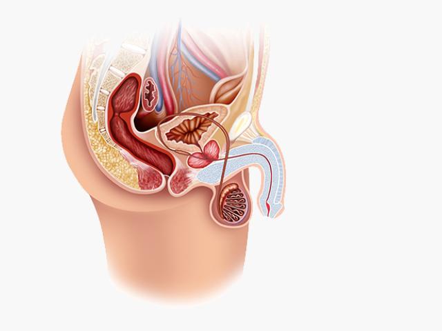 La balanitis causa dolor en el pene, inflamación y comezón