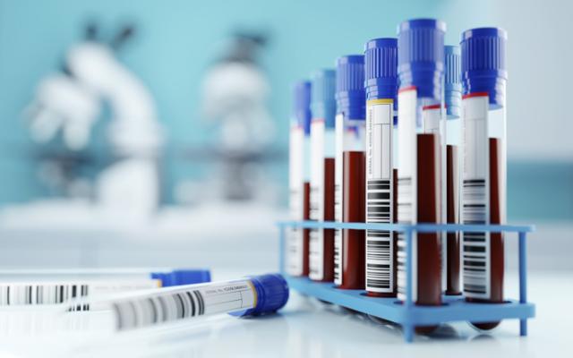 Muestras de sangre para BRCA1